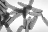 Legionella Pneumophila - Legionellen Keime. Quelle: http://commons.wikimedia.org/wiki/Template:PD-USGov-HHS-CDC